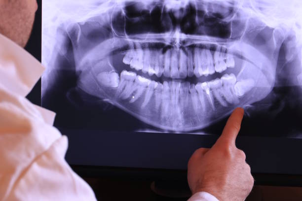 Best Emergency Treatment for Dental Infections or Abscesses in Pendleton, OR