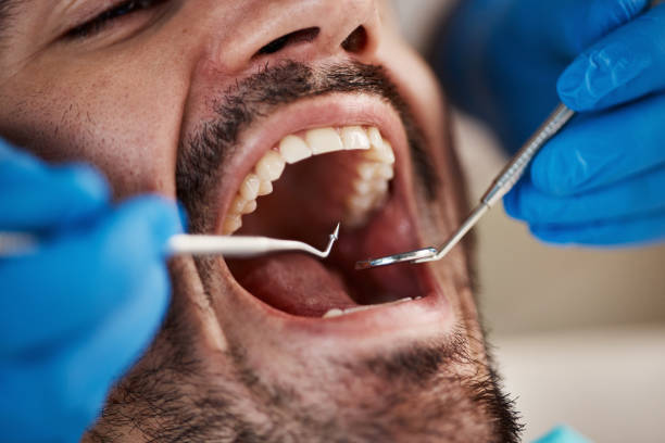 Best Emergency Treatment for Dental Infections or Abscesses in Pendleton, OR
